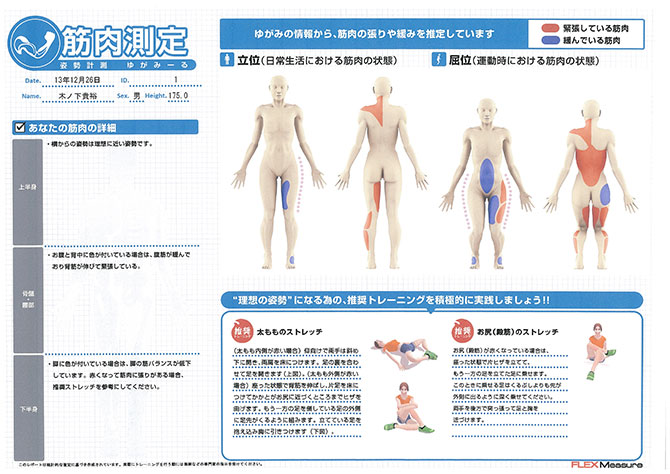 姿勢測定・姿勢評価システム「ゆがみーる」 ｜ 木ノ下整骨院 向日市寺
