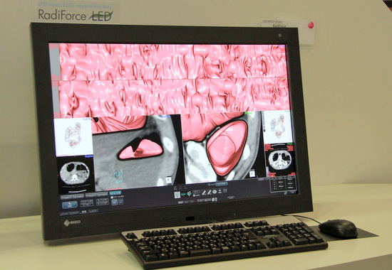 メディカルwatch » Blog Archive » EIZO（ナナオ）