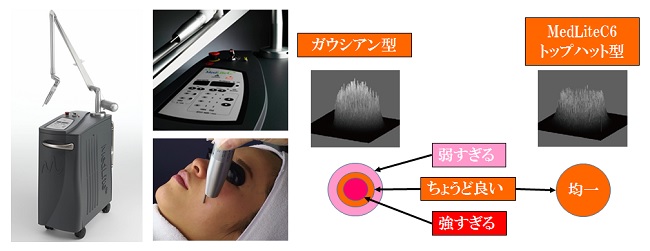 吉祥寺・渋谷・荻窪のシミ取りレーザー治療 | 三鷹台ヒルズクリニック