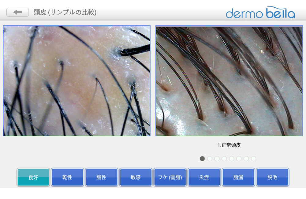 カウンセリングマイクロスコープ頭皮用 3R-WMBTPRIME-H | スリーアール
