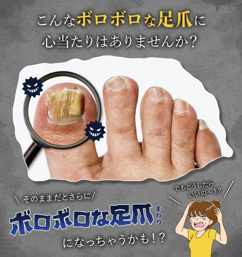 楽天市場】薬用ATジェル 爪ケア 足爪 ひび割れ 乾燥 割れ爪 有効成分