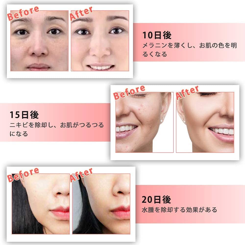 楽天市場】超音波 高周波RF美顔器 イオン導入 EMS ラジオ波 光エステ