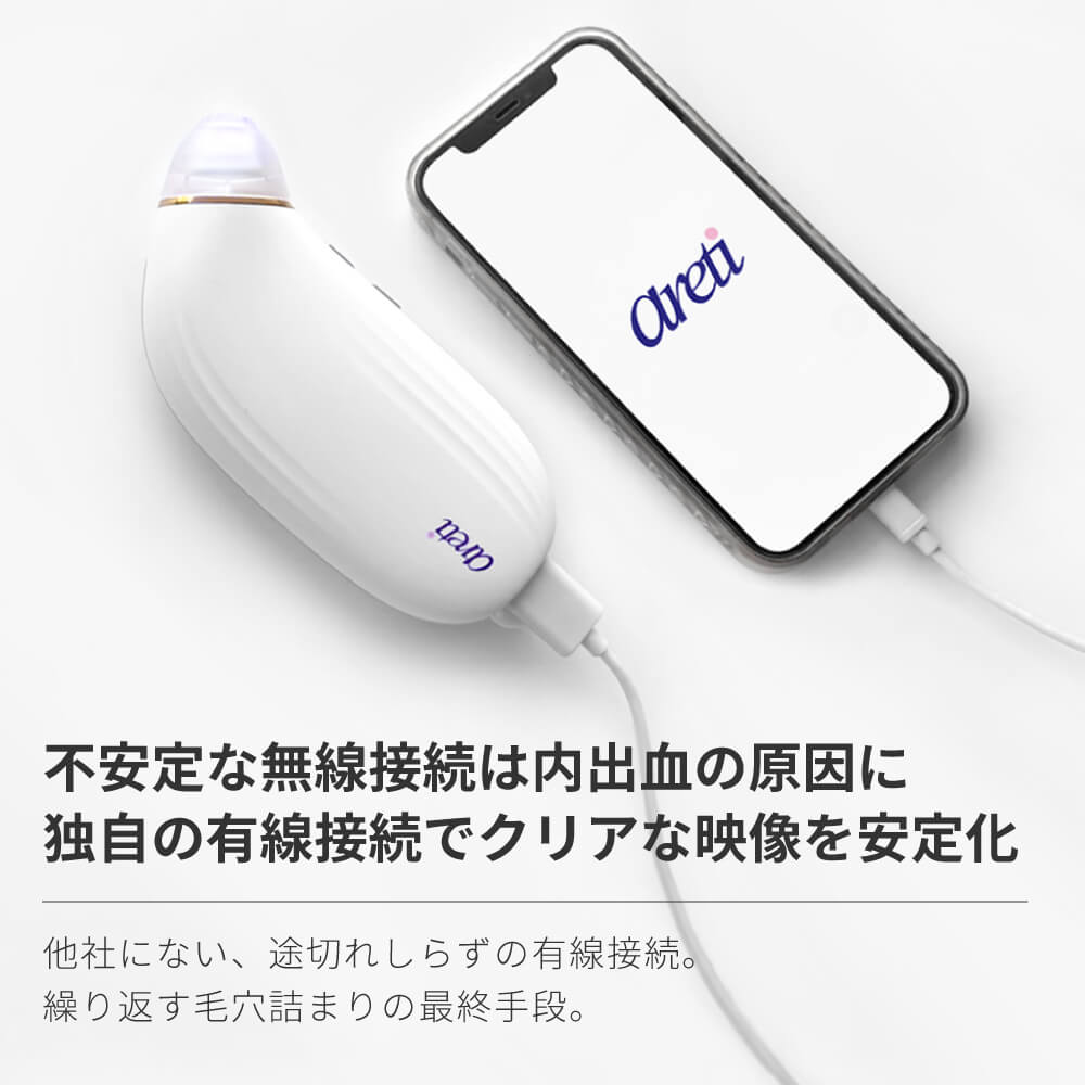 楽天市場】Areti アレティ 毛穴吸引器 スマホ連動 吸引式 スキンケア
