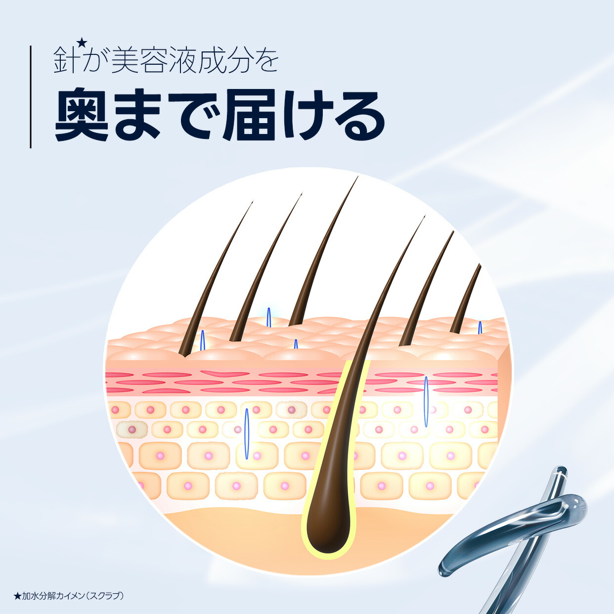 楽天市場】頭皮用 美容液 リペアシューター ヘアニードルセラム 【35