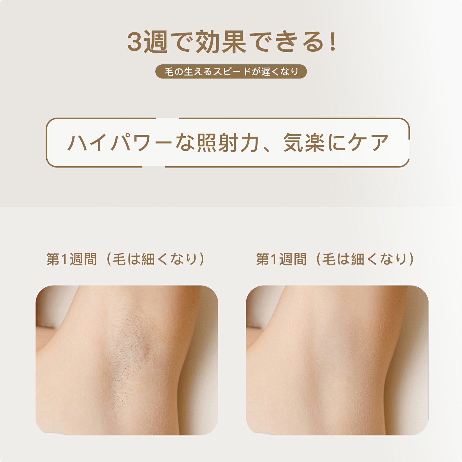 楽天市場】【supersale】yete（エイティー）脱毛器 サファイア冷却技術