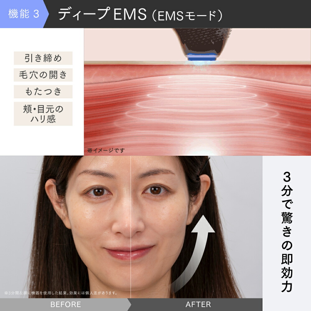 楽天市場】【公式｜スーパーSALE 10%OFFクーポン+P10倍！】リン