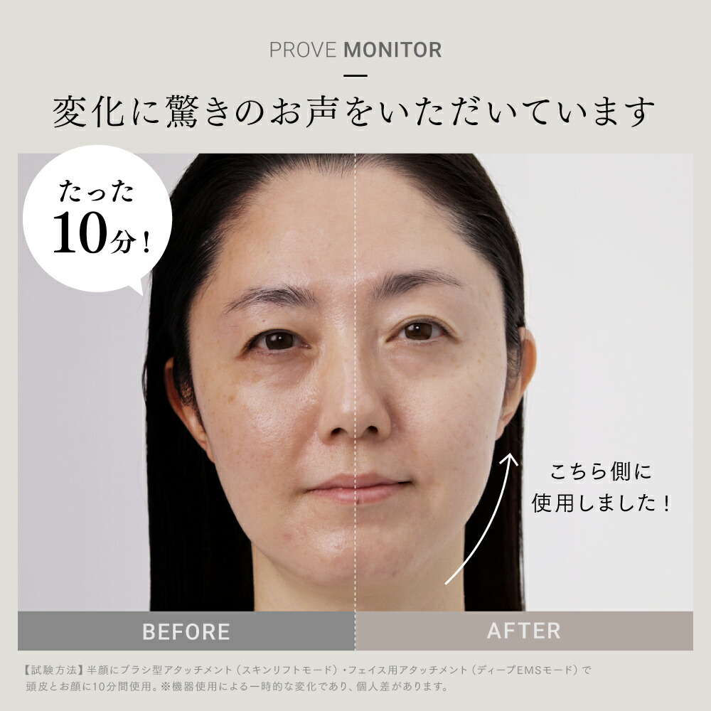 楽天市場】【公式｜スーパーSALE 10%OFFクーポン+P10倍！】EMS 美顔器