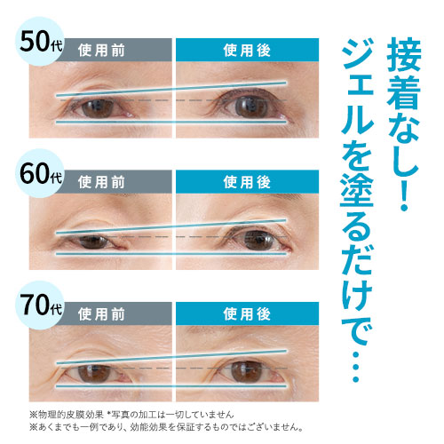 楽天市場】【10%OFFクーポン配布中】[2本セット] まぶた 引き上げ