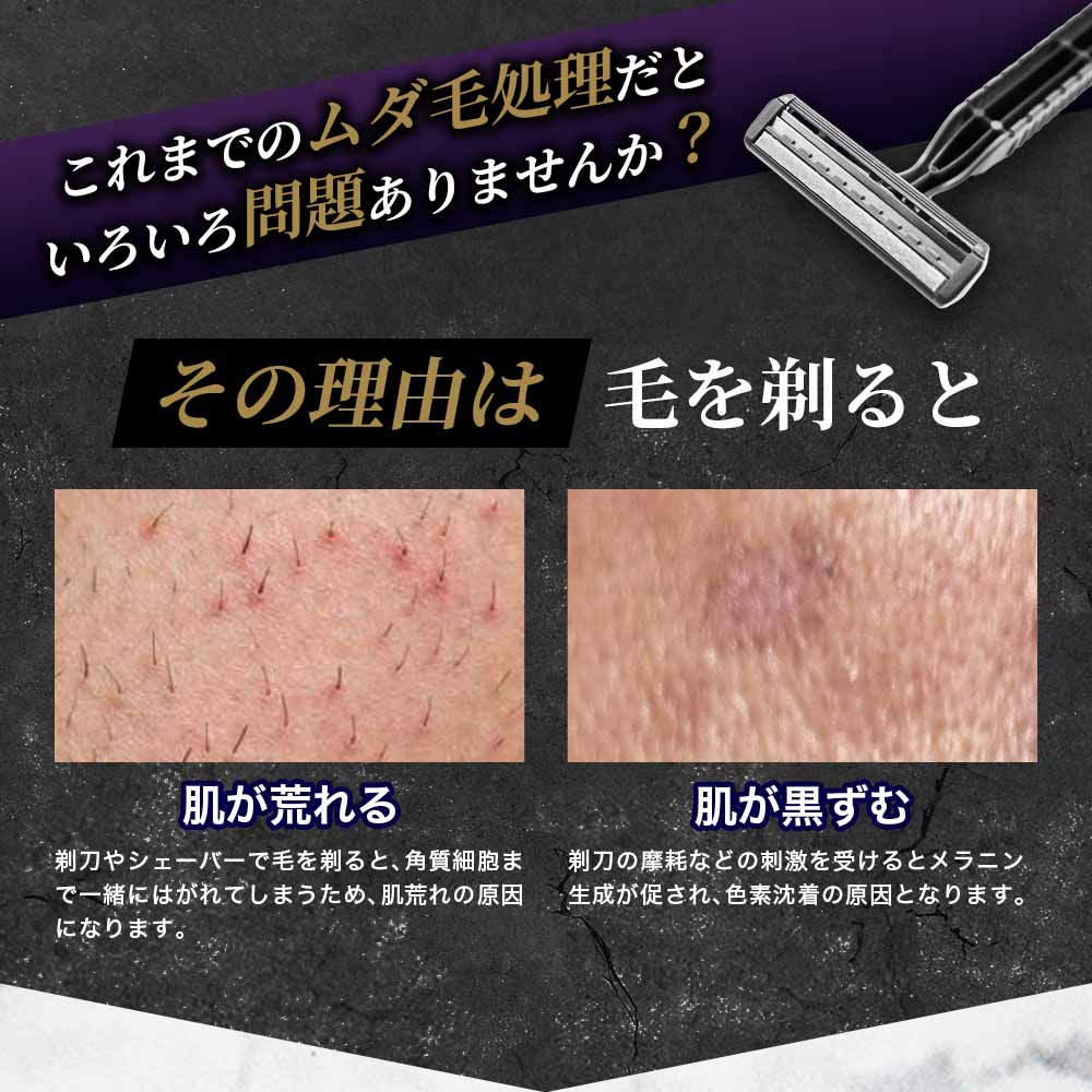 楽天市場】ムダ毛処理 メンズ むだげ処理 男性 ゼノクス オメガ
