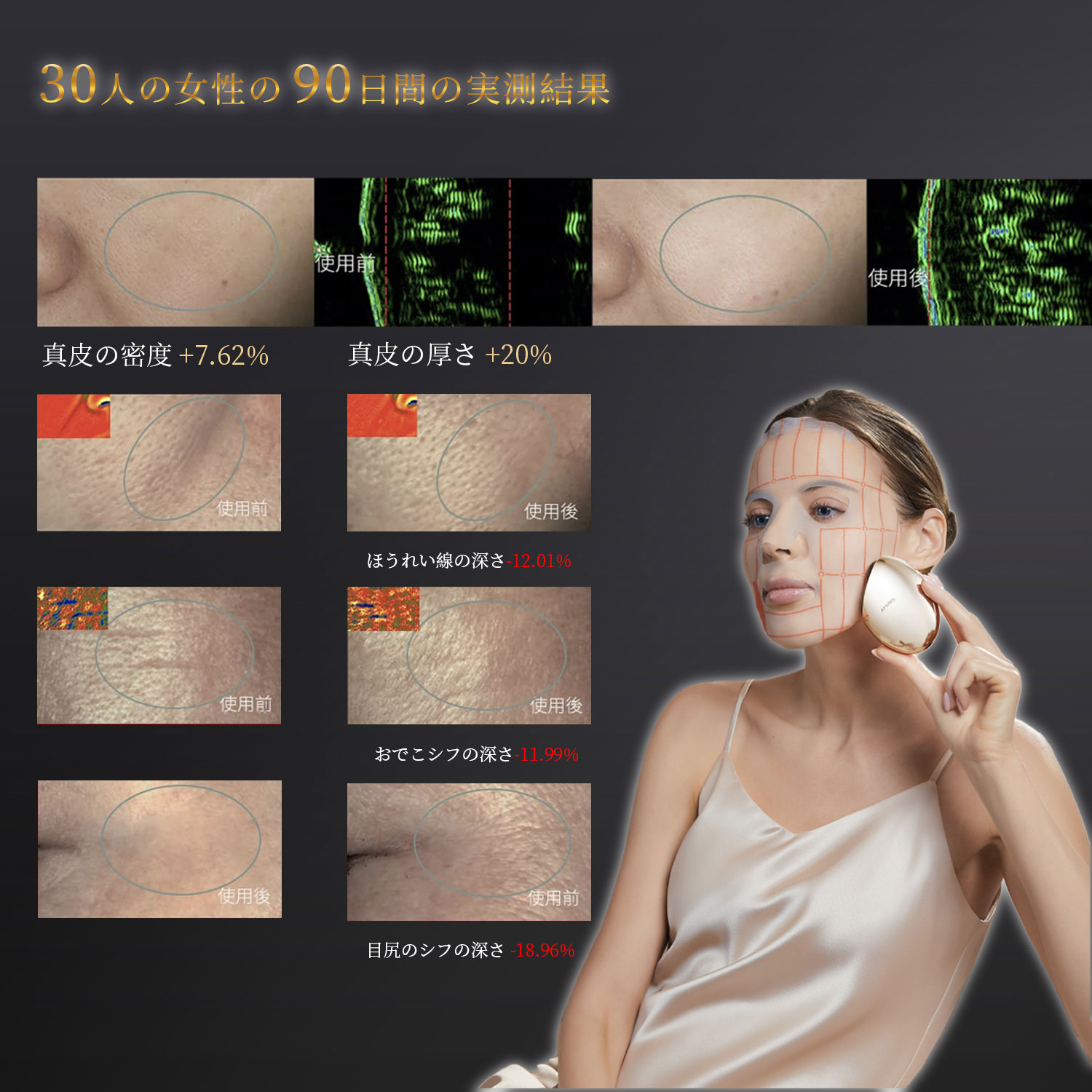 輸入版】AMIRO 最新スタンプ式RF美顔器 EMS 楽天市場】「時間限定