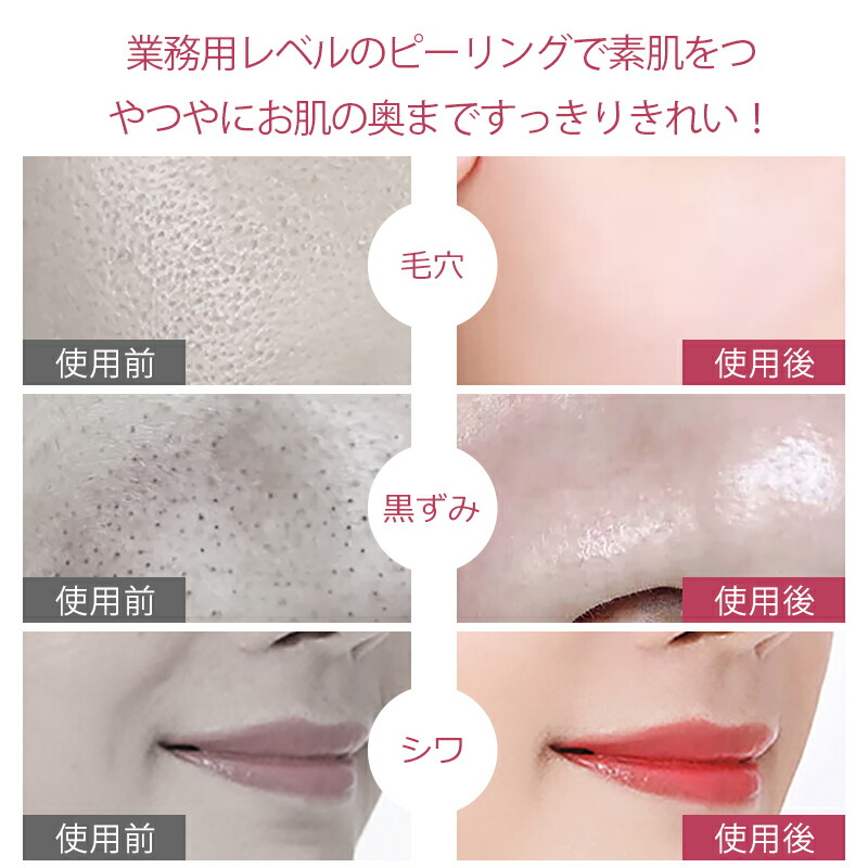 楽天市場】【74％OFF☆スーパーSALE限定】 ウォーターピーリング 美顔