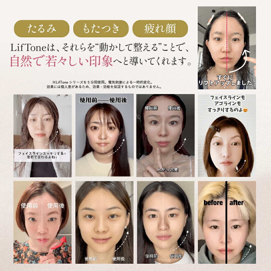 楽天市場】EMS 美顔器 トータルケア美顔器 LifTone リフトーン リフト