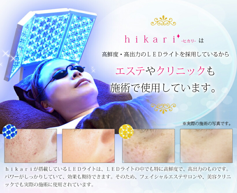 楽天市場】【楽天スーパーセール】美ルル ヒカリフォトフェイシャル