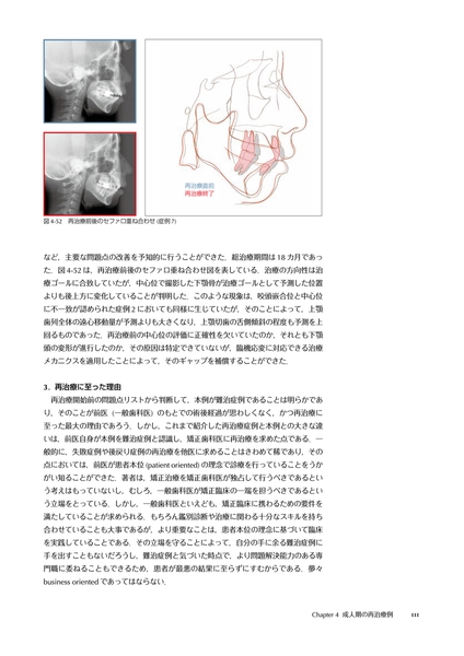 歯列矯正治療の失敗と再治療