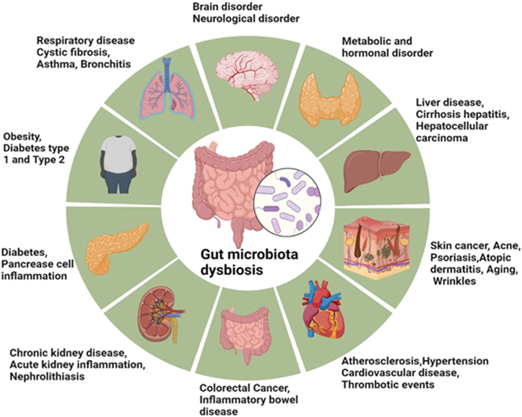 Frontiers | Gut microbiota therapy in gastrointestinal diseases