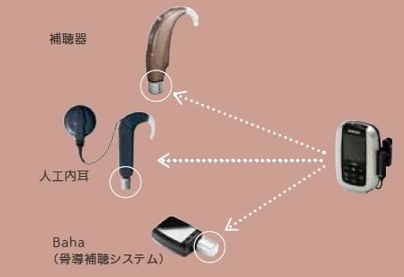 Roger X が補聴器にも人工内耳にも使用できる訳 | きこえのブログ by