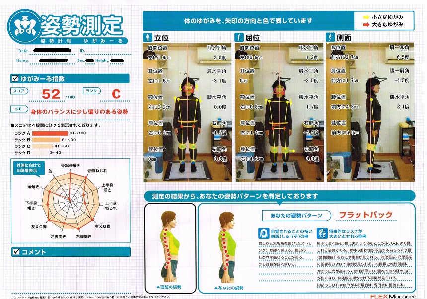 ゆがみーるでの分析 | 大阪狭山市・みわカイロプラクティック整体院