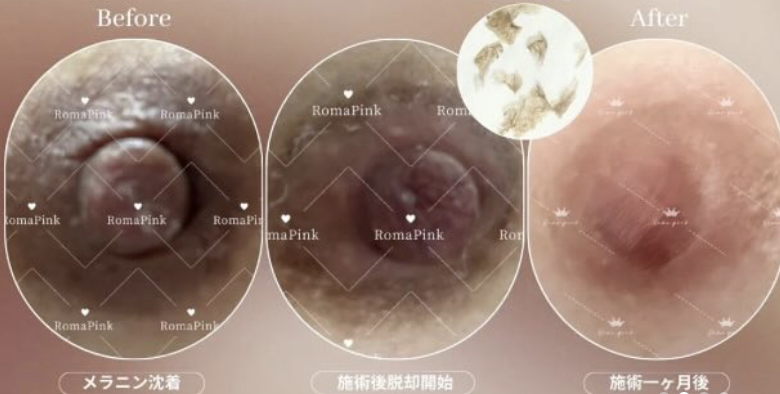 お知らせ | 麻布十番・六本木 筋肉・美容クリニック