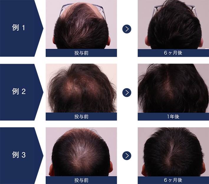 新品未使用】Sedy 01 三点セット×5本 SBC AGA 2026年最新】SEDY