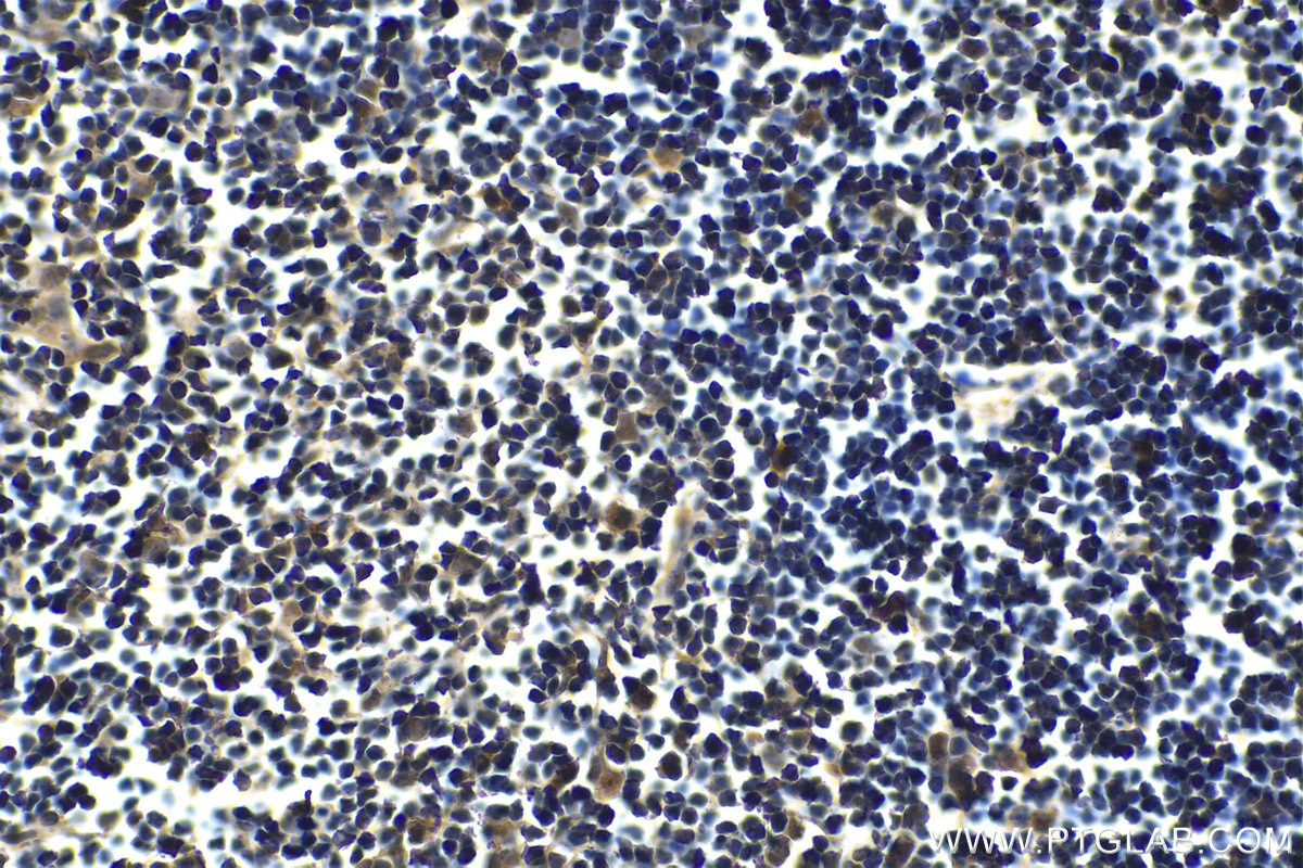 FOXN1 antibody (66337-1-Ig) | Proteintech