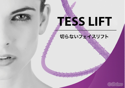 TESS LIFT（切らないフェイスリフト） エイジングケア | プリモ麻布十