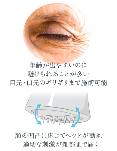 メタジェクト―エステの新たなエイジング解決策｜ウィズ・アス