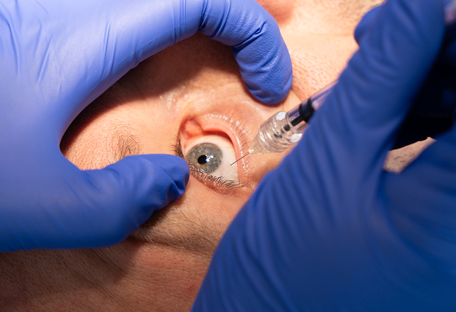 Ophthalmic needles - TSK