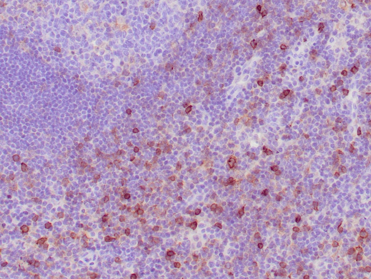 CD25 Antibody - Recombinant IVD Antibody for IHC - Zeta Corporation