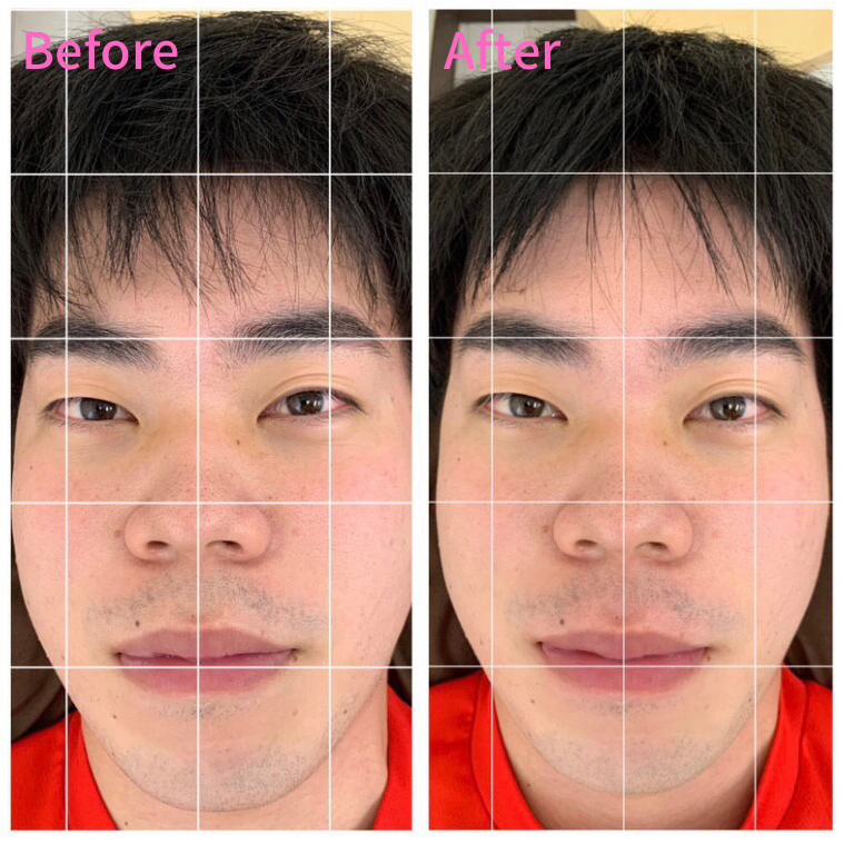 小顔スッキリ（顔の歪み、フェイスライン）｜整体／骨盤矯正なら口コミ