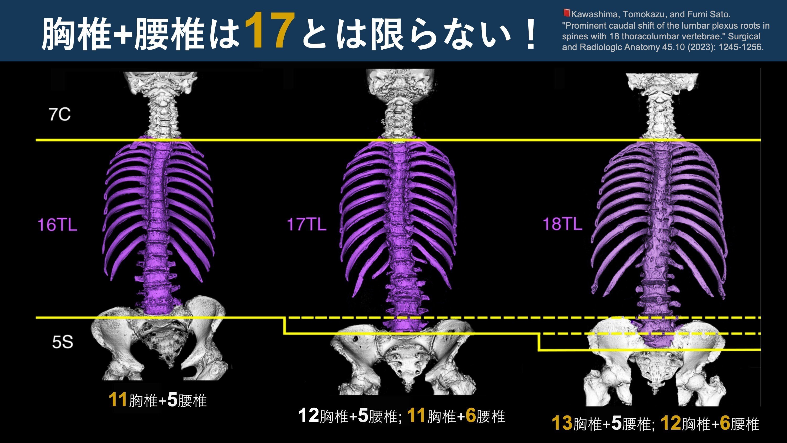 胸椎+腰椎=18個？』。12胸椎, 5腰椎とは限らない｜Super Human | 理学