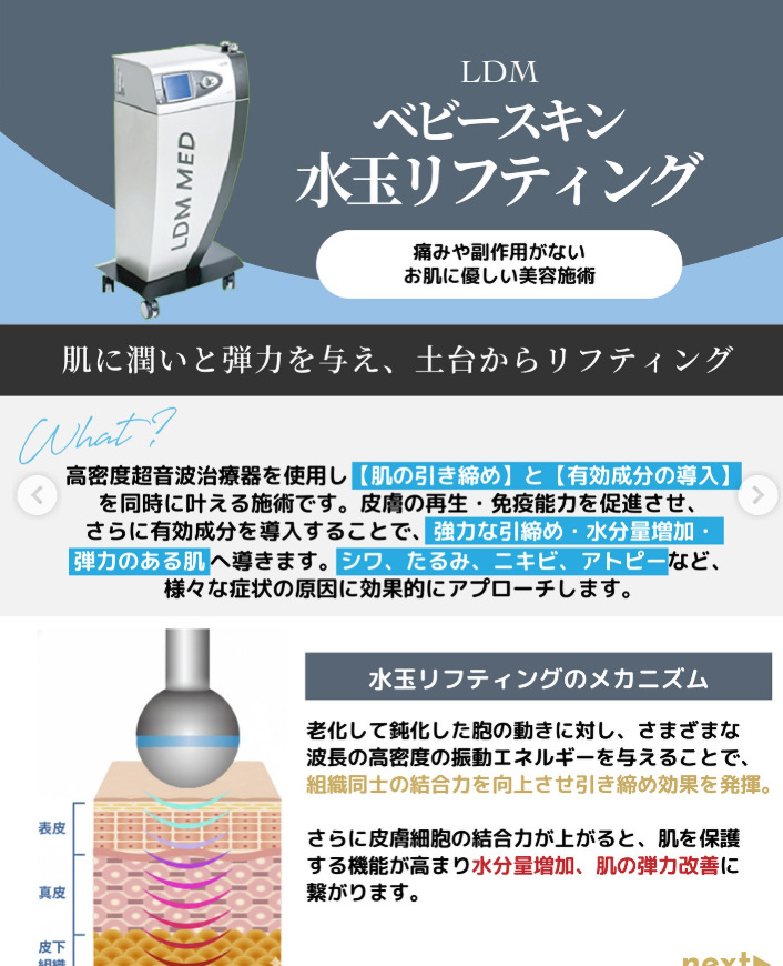湘南美容クリニックの水玉リフティング（LDM）を受けた人の口コミ