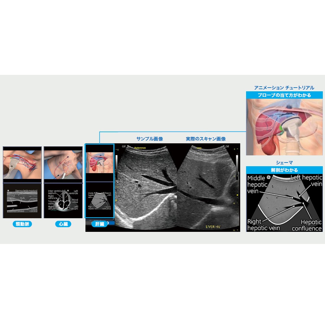 Versana Premier | 映像情報Medical