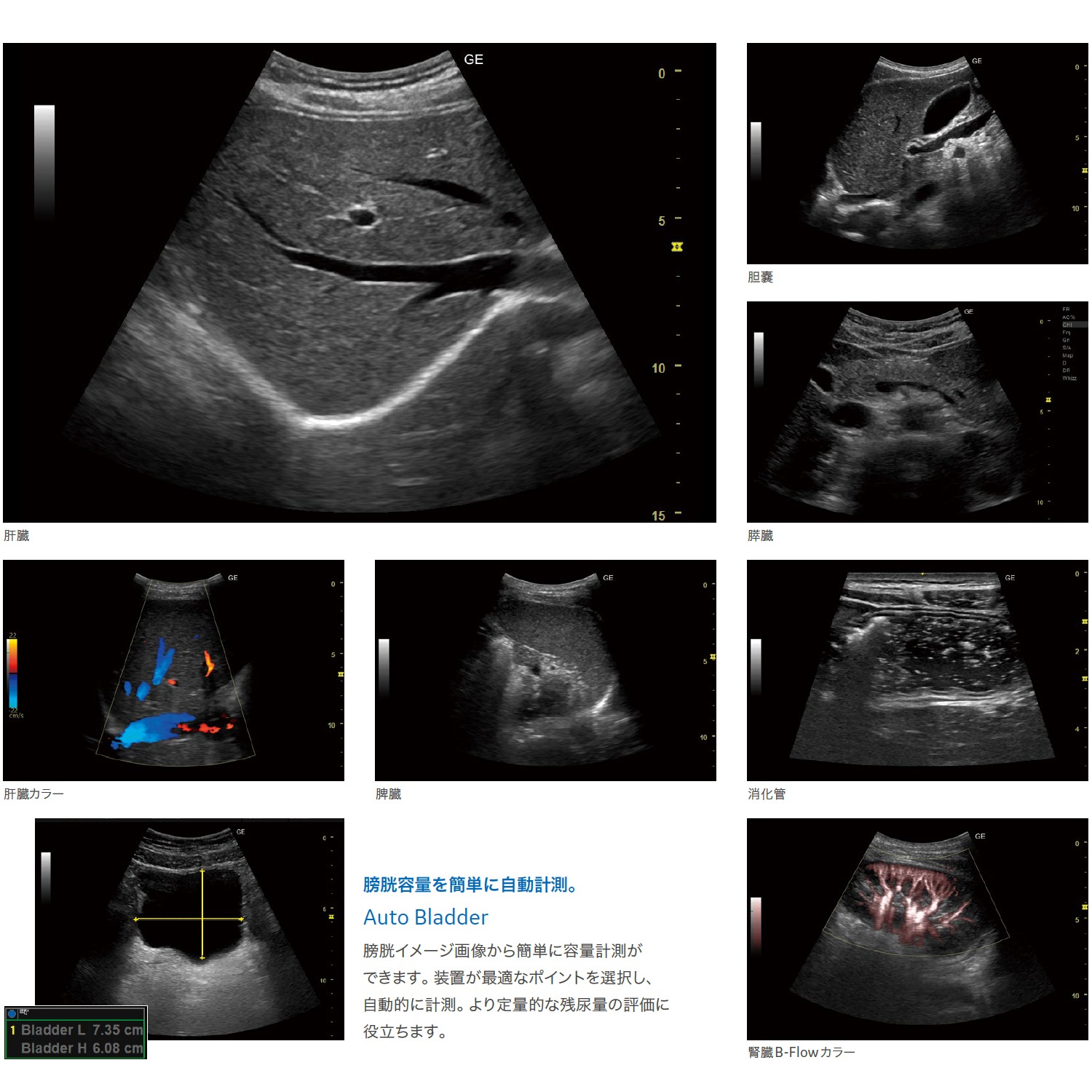 Versana Premier | 映像情報Medical