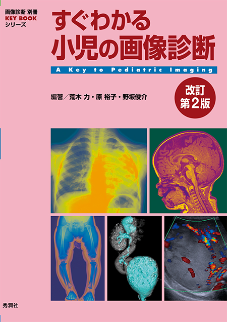 m3電子書籍 | 画像診断別冊 KEY BOOKシリーズ すぐわかる小児の画像