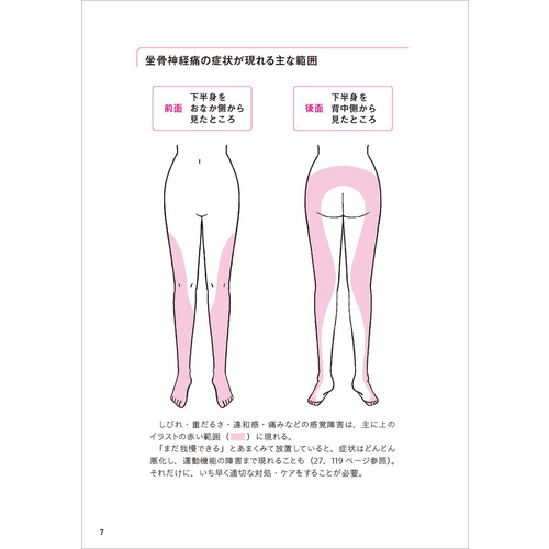図解 今すぐ治せる！ 坐骨神経痛|酒井 慎太郎(著)|ショップ学研＋
