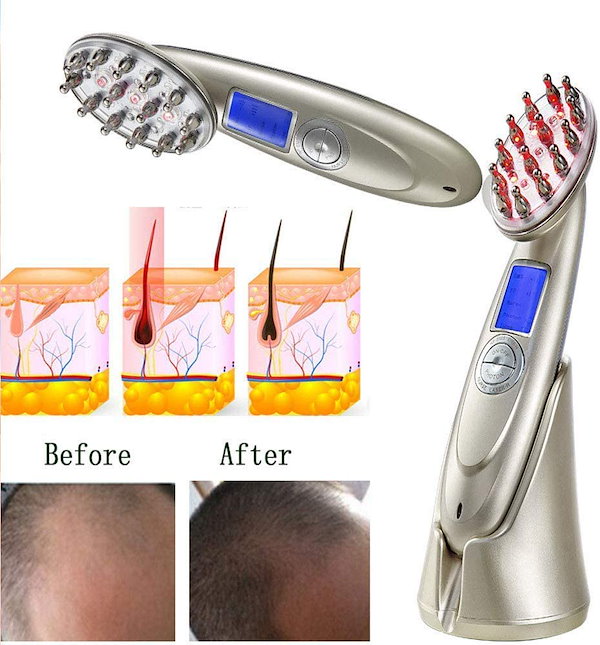 Qoo10] 電動頭皮ブラシ 育毛 RF温熱 EMS