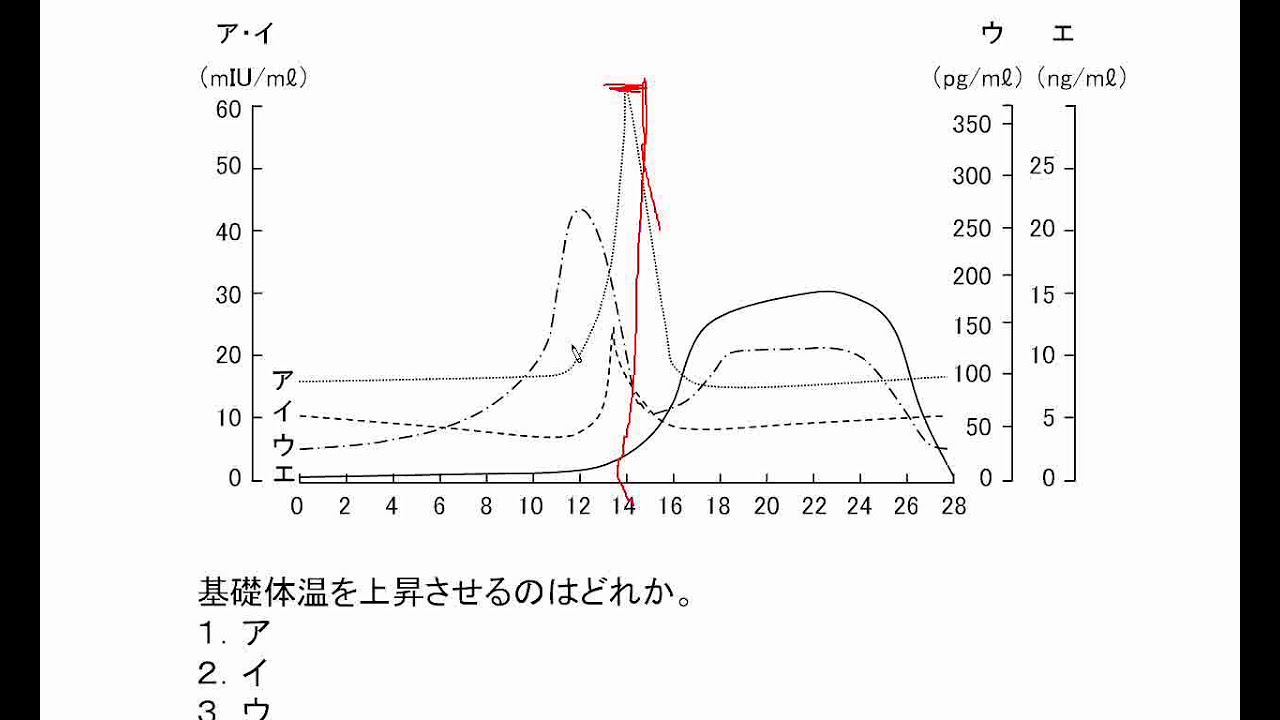 看護師国家試験過去問｜94回午後14｜吉田ゼミナール - YouTube