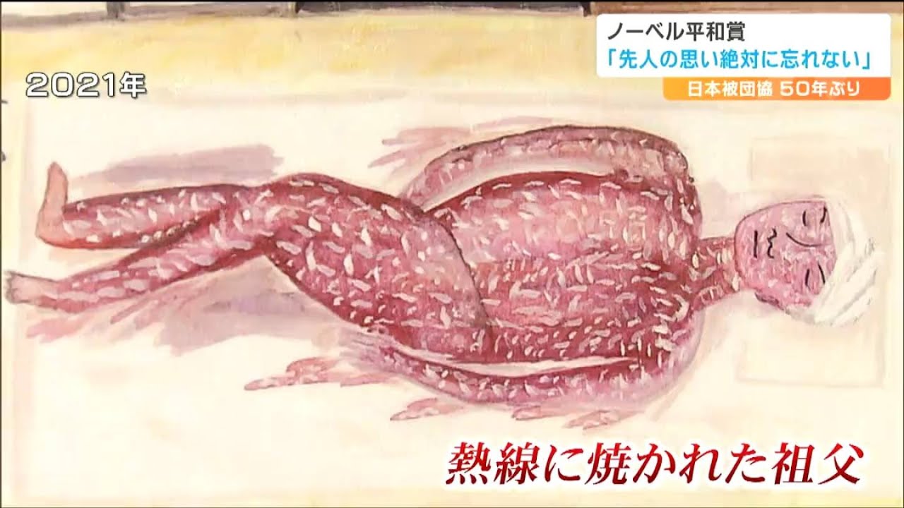 8歳のときに負った傷がずっとこの運動につながっている」被爆者・木村