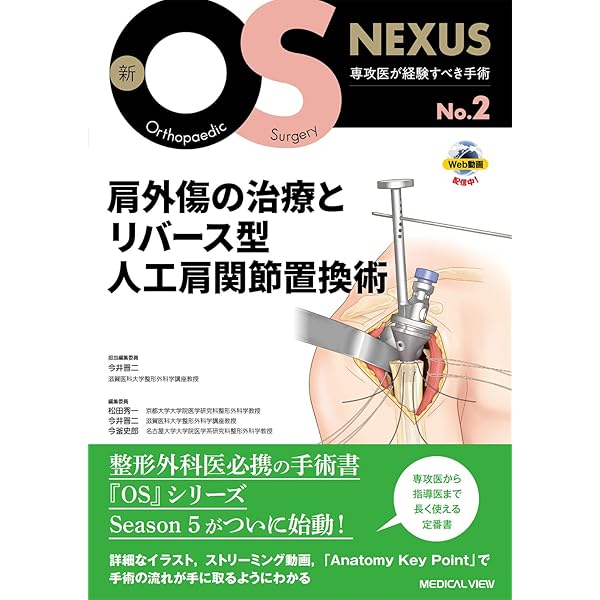 Amazon.co.jp: 人工肩関節置換術: HHR・TSA・RSA (整形外科SURGICAL