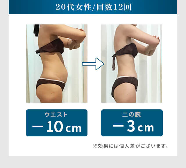 電磁パルス痩身｜仙台市で話題の最新EMSダイエット｜さとう接骨院
