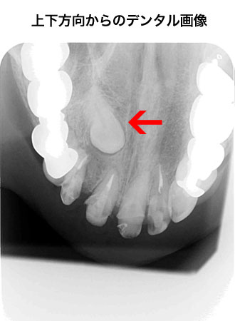 デジタルレントゲン | 風間歯科医院｜中野市・飯山市・須坂市・長野市