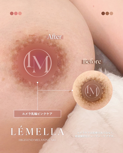 TOP - English - LÉMELLA JAPAN