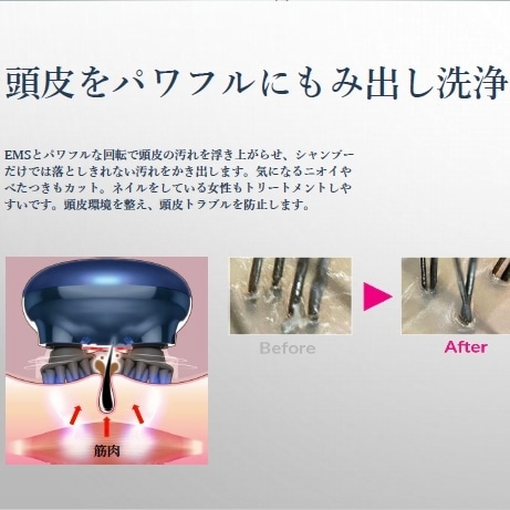 アルベリーモ EMS ヘッドスパリフト | 取扱ブランド商品 | AnnCrea