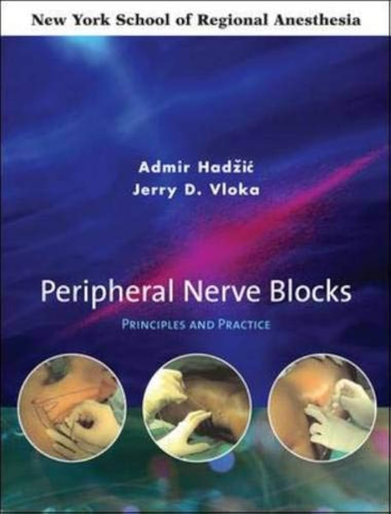 Peripheral Nerve Blocks: Principles and Practice: 9780071409186