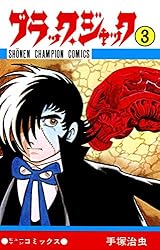 Amazon.co.jp: ブラック・ジャック 24 ブラック・ジャック (少年