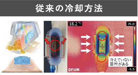 業務用脂肪冷却痩身機フリーズドエッジ｜MRO