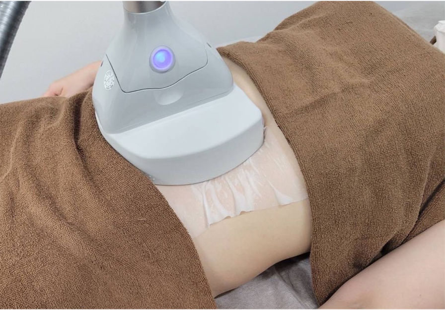 業務用脂肪冷却痩身機フリーズドエッジ｜MRO