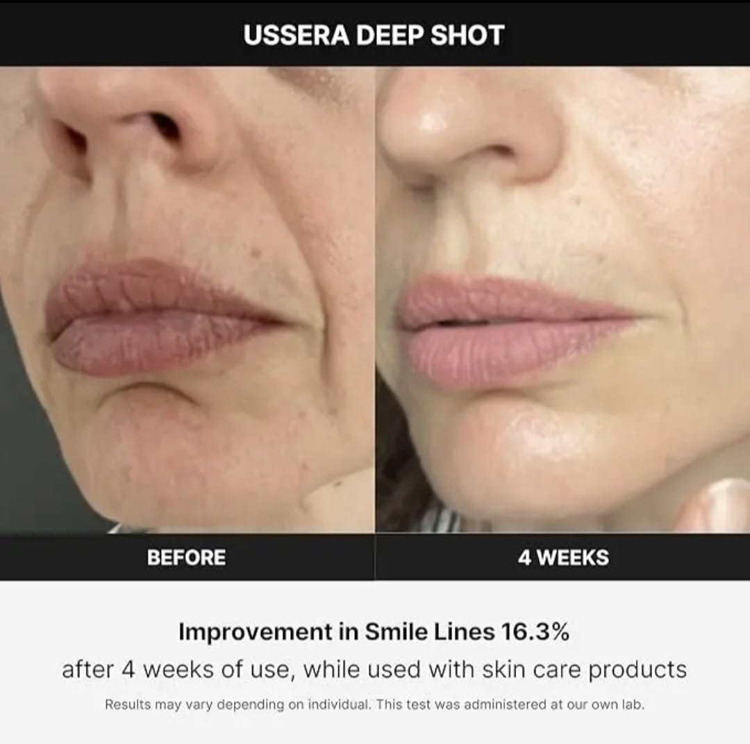 Age R Medicube Ussera Deep Shot - SkinSoft