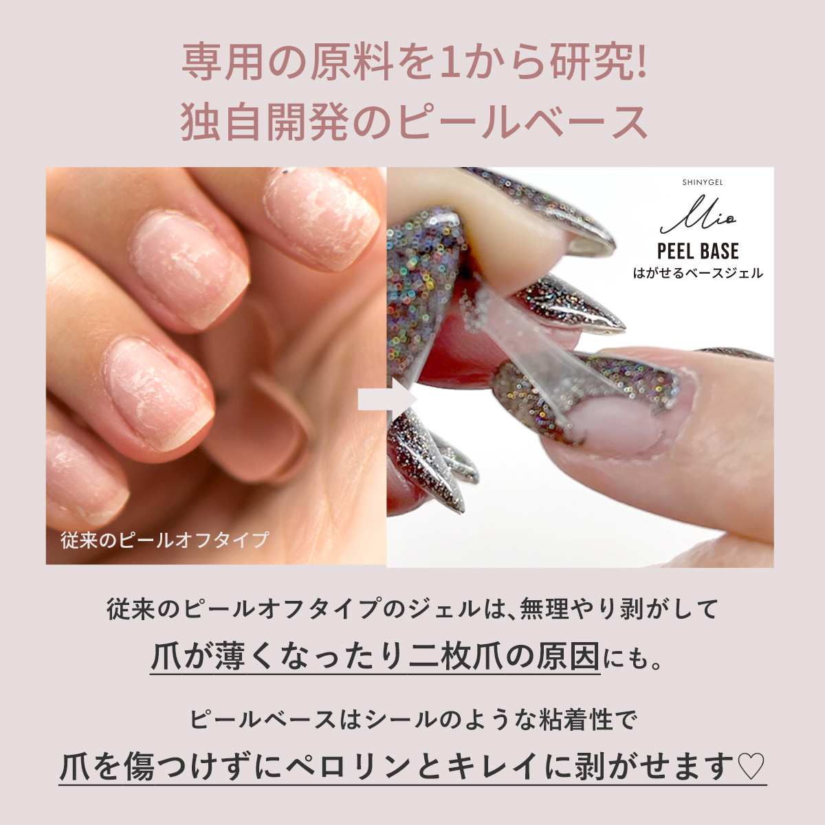 SHINYGEL Mio：ベーシックセット（ピールベース、ワイプレストップ