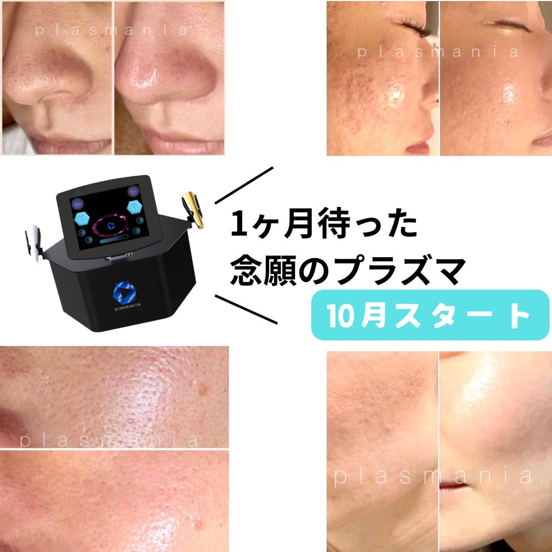 プラズマご予約開始/福岡プラズマニア | 40歳から本格的肌ケア|40代